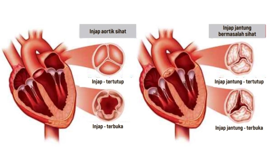 jantung sihat